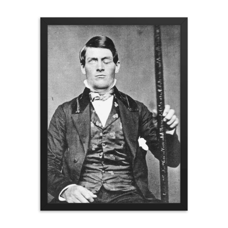 Phineas Gage framed print on a plain backdrop in size 18