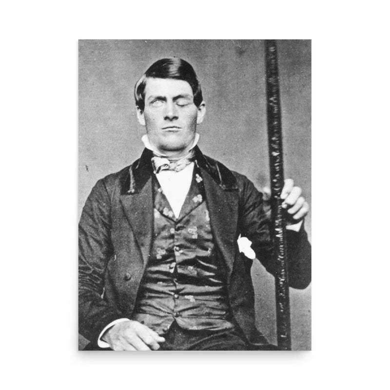 Phineas Gage poster on a plain backdrop in size 18