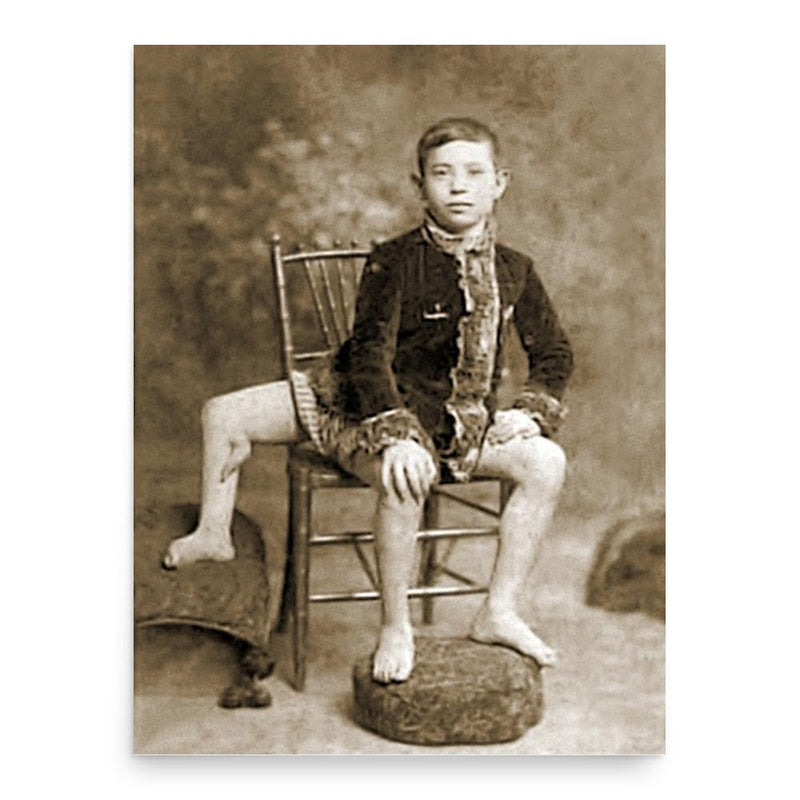 Frank Lentini poster print, in size 18x24 inches.